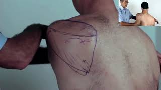 Trigger Point Master Class  How to Release Infraspinatus [upl. by Colwell]