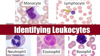 Identifying Leukocytes [upl. by Jopa]