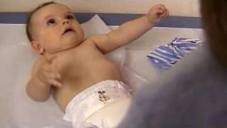 Understanding Infantile Spasms [upl. by Gaelan]