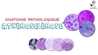 Anatomie Pathologique  Athérosclérose [upl. by Enened300]