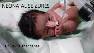 Neonatal Seizures  Pediatrics [upl. by Lemor]