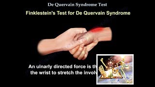 De Quervain Syndrome Test  Everything You Need To Know  Dr Nabil Ebraheim [upl. by Onaicram]