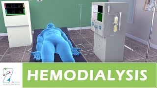 Hemodialysis [upl. by Anaid195]