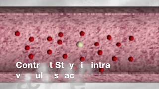 TMT CONTRAST ENHANCED ULTRASOUND CEUS BASICS [upl. by Dnalrah]