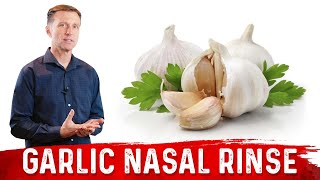 Natural cure for sinusitis  Dr Nidhi Navani [upl. by Pulchi221]