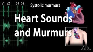 Heart Sounds and Heart Murmurs Animation [upl. by Einwahs]