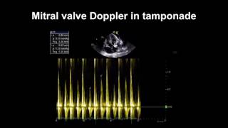 Lecture 2  Transthoracic Echocardiography Part 1 [upl. by Hahn694]