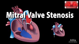 Valves mitrale et tricuspide [upl. by Grail]