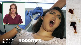 Doctor Explains Earwax Removal  Boddities [upl. by Persis]