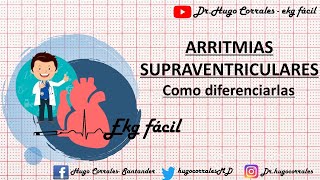 ARRITMIAS SUPRAVENTRICULARES  como diferenciarlas [upl. by Can]