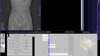 2 intravenous Urography SPECIAL RADIOGRAPHIC PROCEDURES [upl. by Ynahpets]