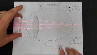 Vision Correction Normal Eyes Myopia Hyperopia Near amp Far Point Lens Power [upl. by Enelrihs393]