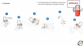 INHALERS TYPES amp HOW TO USE [upl. by Bodi]