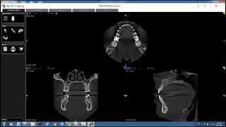 Carestream 3D Imaging  Receiving CBCT Scans [upl. by Greenwald]