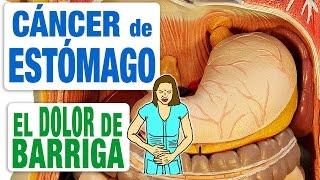 El Dolor de Barriga en el Cáncer de Estómago [upl. by Iosep]