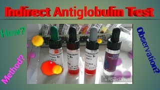 Indirect Antiglobulin Test  Indirect Coombs Test Hematology [upl. by Eirrehc]