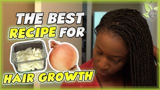 The BEST Onion Juice Recipe for Maximum HAIR GROWTH [upl. by Seilenna]