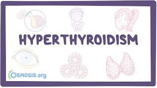 Hyperthyroidism  an Osmosis Preview [upl. by Mattheus]