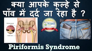 Piriformis Syndrome Hindi [upl. by Brainard]