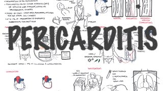 Septal Bounce  Constrictive Pericarditis  Thuan Nguyen [upl. by Gabie]