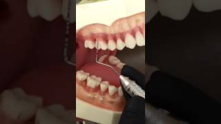 Professor Norrell How to Measure Gingival Recession [upl. by Lew]