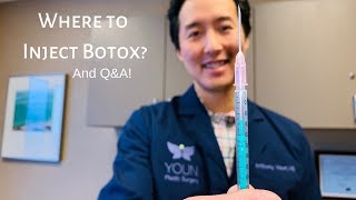 UNDER EYE BOTOX Experience amp Footage  BeforeAfter Cost Pain Bruising [upl. by Klenk]