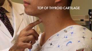 The Thyroid Exam Stanford Medicine 25 [upl. by Asyram]