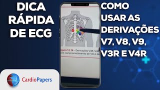 Como usar as derivações V7 V8 V9 V3R e V4R [upl. by Gudren]