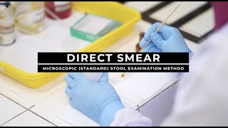 Direct Smear  Microscopic Standard Stool Examination Method [upl. by Assenaj480]