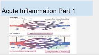 Acute Inflammation Part 1 [upl. by Eugenia]