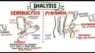 Failing Kidneys and Different Treatment Options [upl. by Ecadnac984]