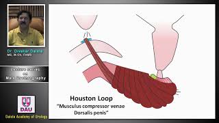 PUJO Pelviureteric junction obstruction Pediatric Surgery [upl. by Eidnam]