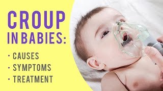 Croup in Babies  Causes Symptoms and Treatment [upl. by Adiesirb]