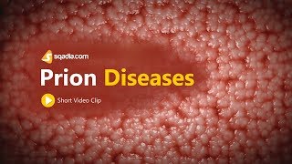 Prion Diseases  Neurology Medicine Animation  VLearning  sqadiacom [upl. by Virginia956]