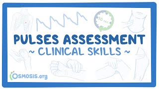 Clinical Skills Pulses assessment [upl. by Canica]