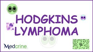 Hodgkins Lymphoma Pathophysiology symptoms and treatment [upl. by Pietrek]