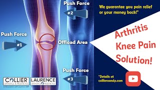 OA Knee Pain How an unloader knee brace works [upl. by Ennaehr957]