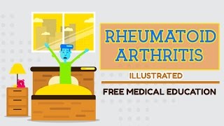 What is Rheumatoid Arthritis [upl. by Waxman398]