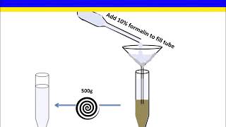 Fecal Flotation Concentration Zinc Sulfate Method [upl. by Ahsil]