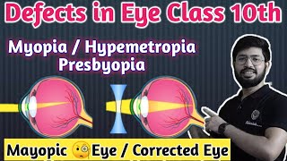 Defect of Eyes with Ray diagram  Myopia Hypermetropia by Abhishek sir [upl. by Hillman]