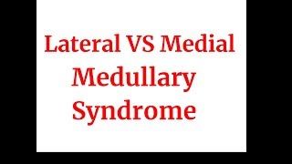 Lateral VS medial medullary syndrome [upl. by Enerual675]