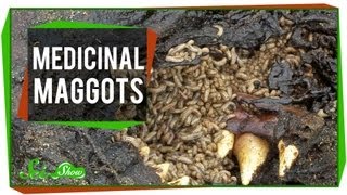 Marvelous Medicinal Maggots [upl. by Materse]