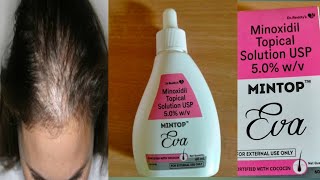 How to use mintop eva 50 solution for hair fall [upl. by Haerr]