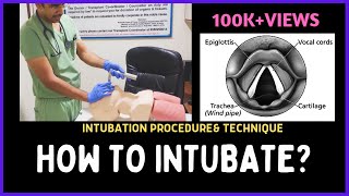 HOW TO INTUBATE INTUBATION PROCEDURE amp TECHNIQUE [upl. by Einrae]