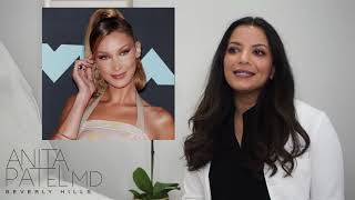 Brow Lift 101 Everything You NEED To Know About an Endoscopic Approach [upl. by Nuavahs]