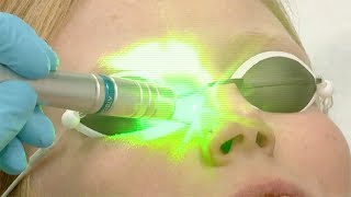 Laserbehandlungen der Haut  skinmed AG [upl. by Cronin]