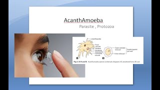 Ophthalmology 121 a AcanthAmoeba Keratitis Pseudo Dendrites eye cornea Contact lens PHMB [upl. by Nonnarb]