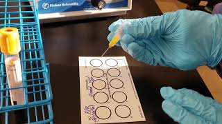 Microbiology Rapid Plasma Reagin RPR Test [upl. by Orutra259]