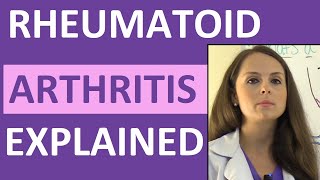 Rheumatoid Arthritis Treatment Options [upl. by Anairam]