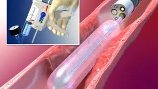 AngioDynamics BioFlo PICC Care and Maintenance Instructional Video [upl. by Atikam853]